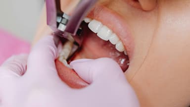 Frau beim Zahnarzt Frau beim Zahnarzt