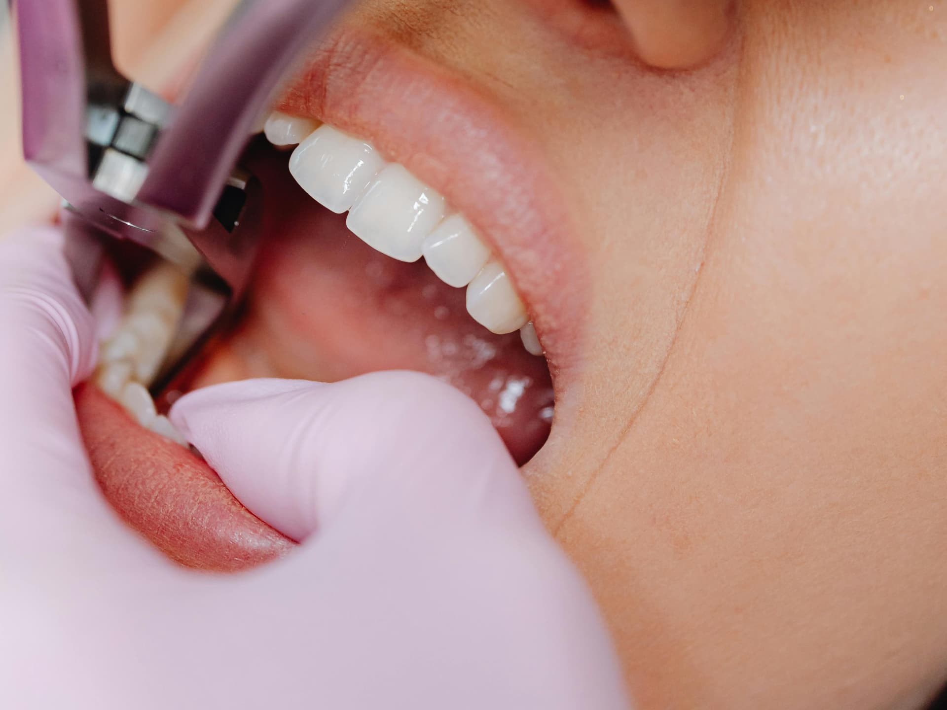 Frau beim Zahnarzt Frau beim Zahnarzt