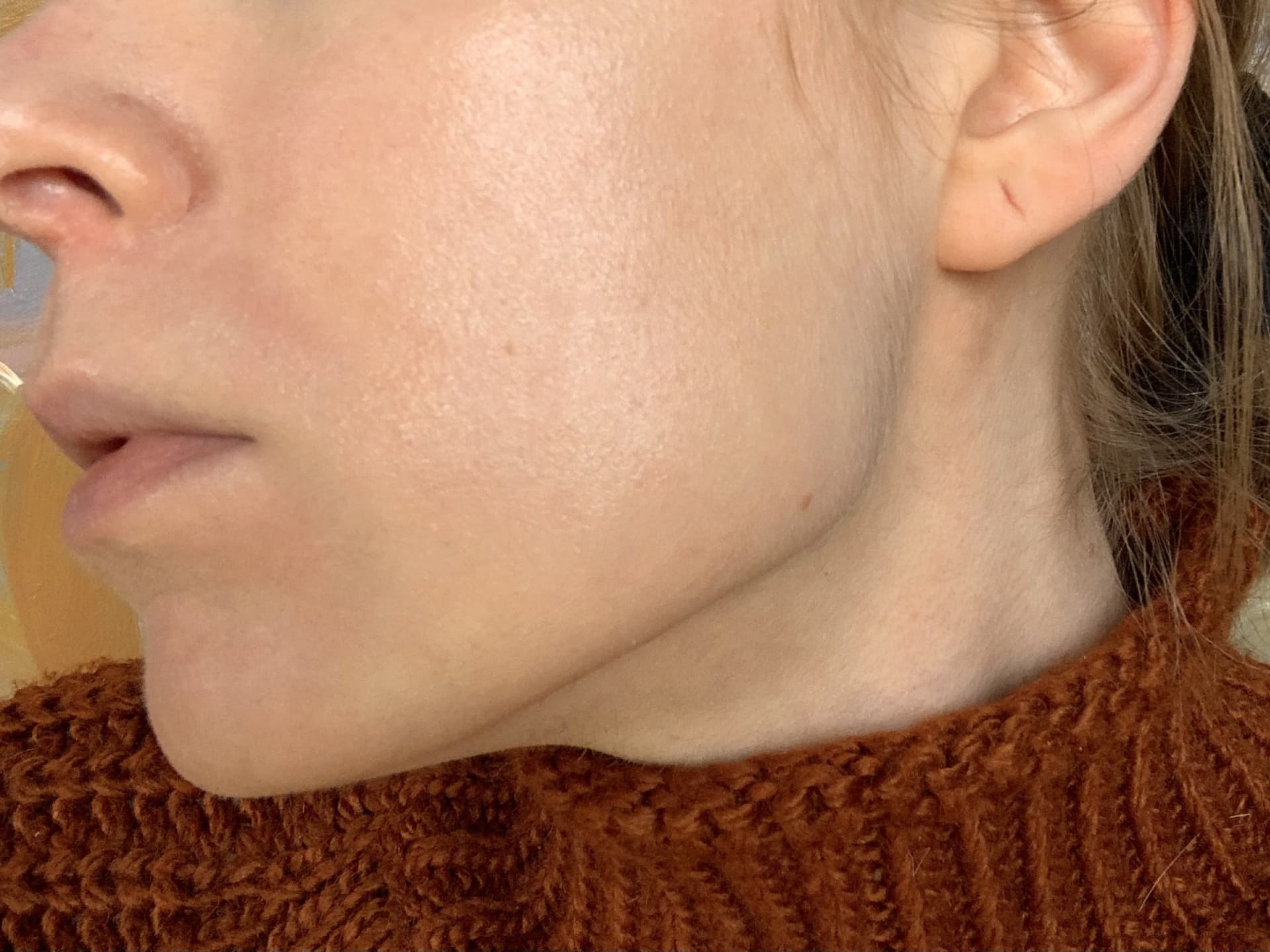Weleda Skin Food Erfahrung Nachher im Detail Weleda Skin Food Erfahrung Nachher im Detail